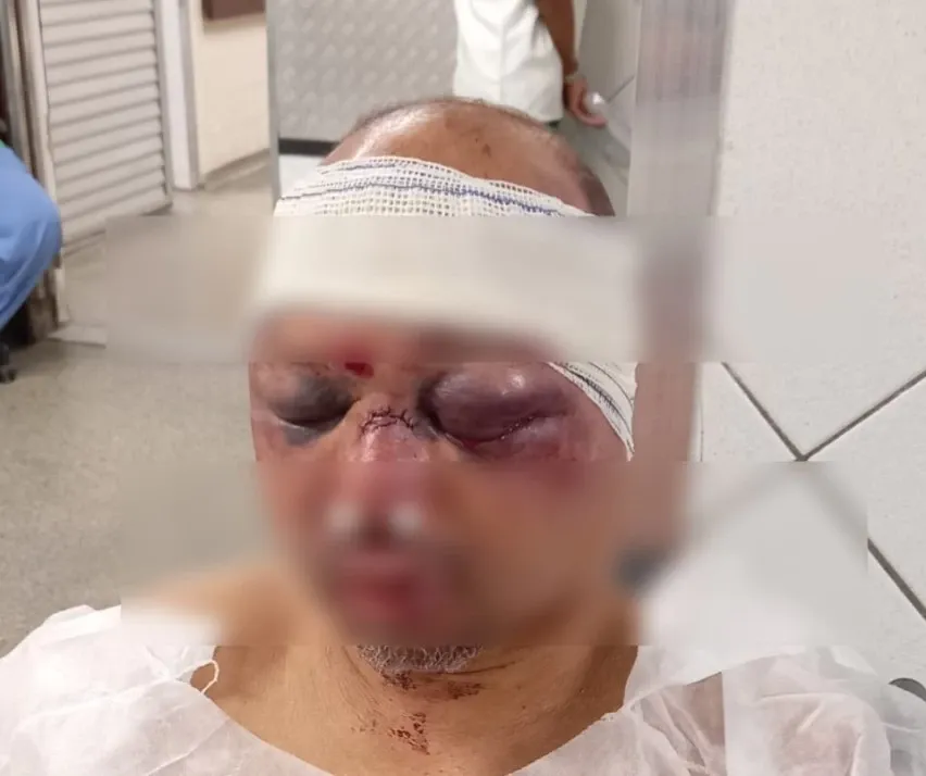 Rodoviário é retirado de residência em Salvador e agredido após denúncia de adolescente