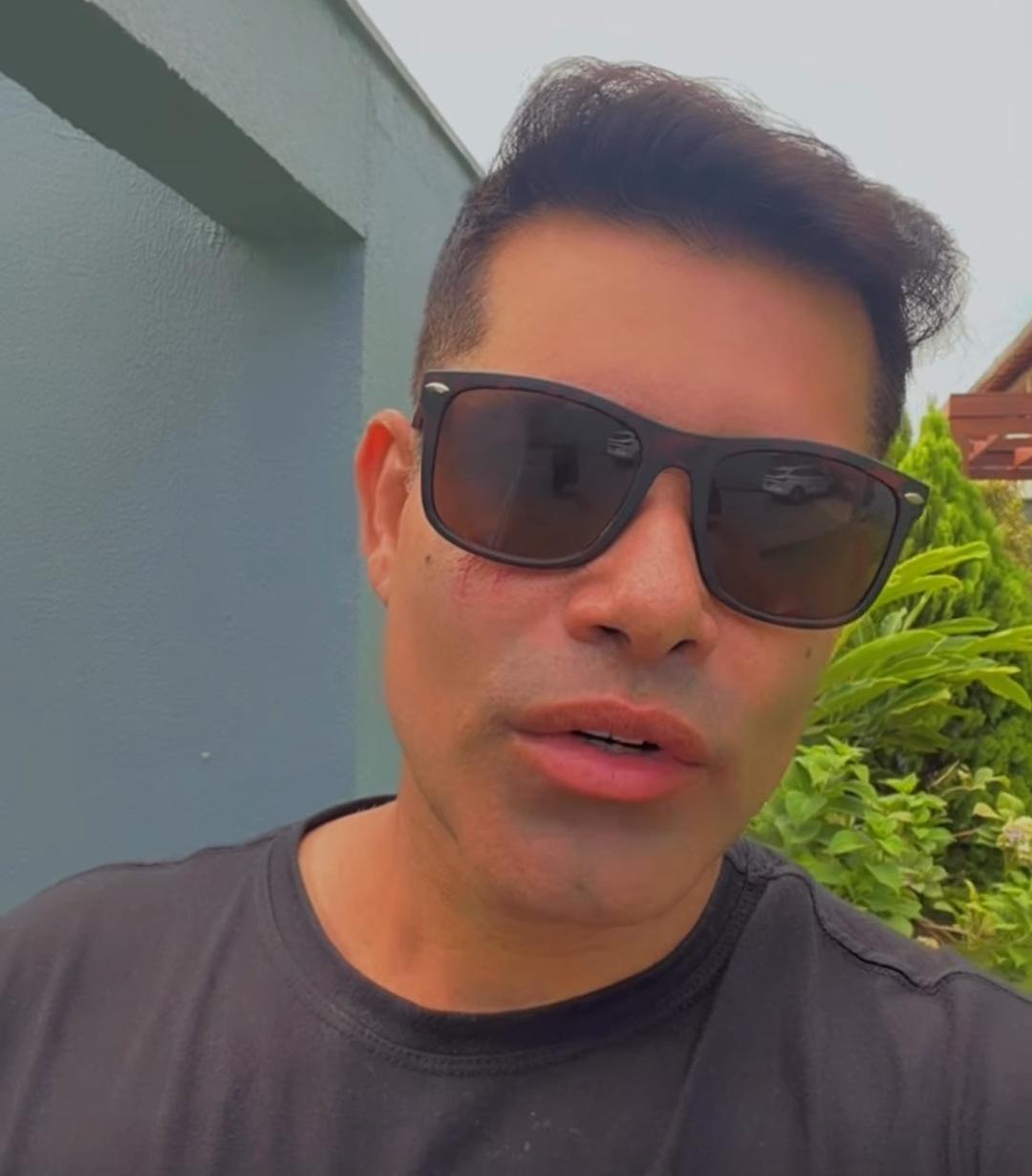 Após acidente, Kiko Chicabana tranquiliza fãs: “Nada de grave aconteceu”