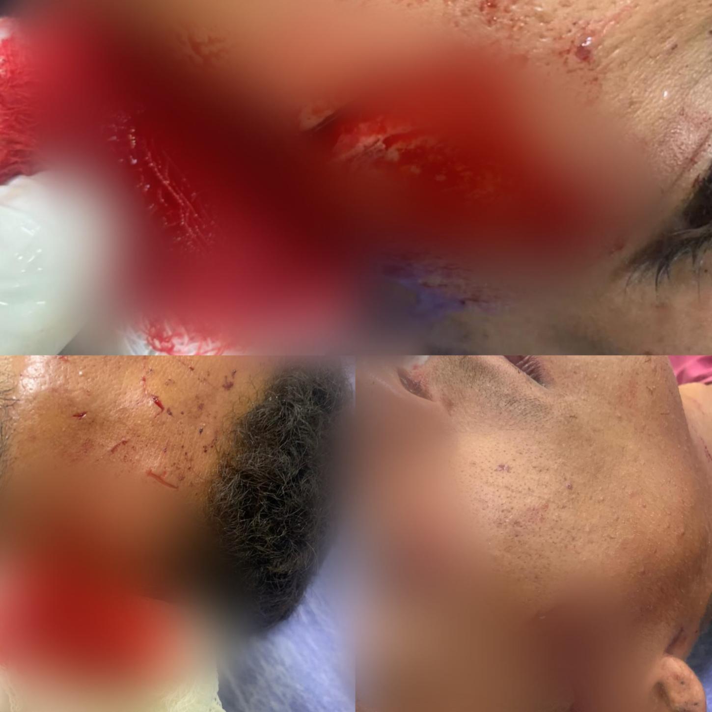 Discussão durante consumo de álcool termina com jovem ferido em Conceição do Coité